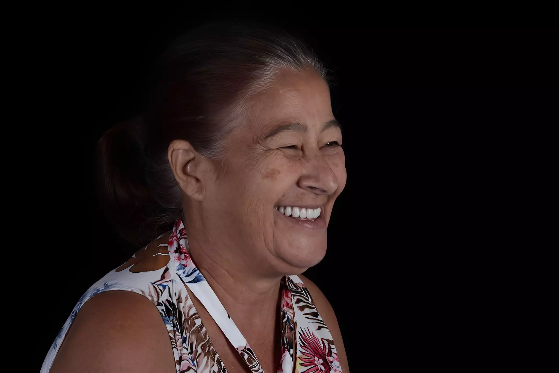 Sorriso lindo após o tratamento de dentística restaurado