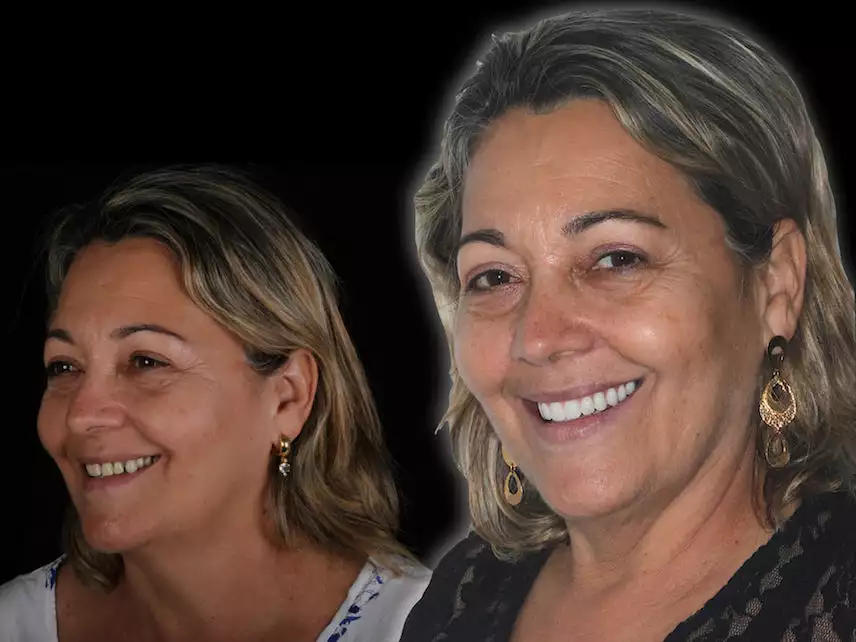 mulher idosa posando e sorrindo para a câmera, mostrando os dentes alinhados