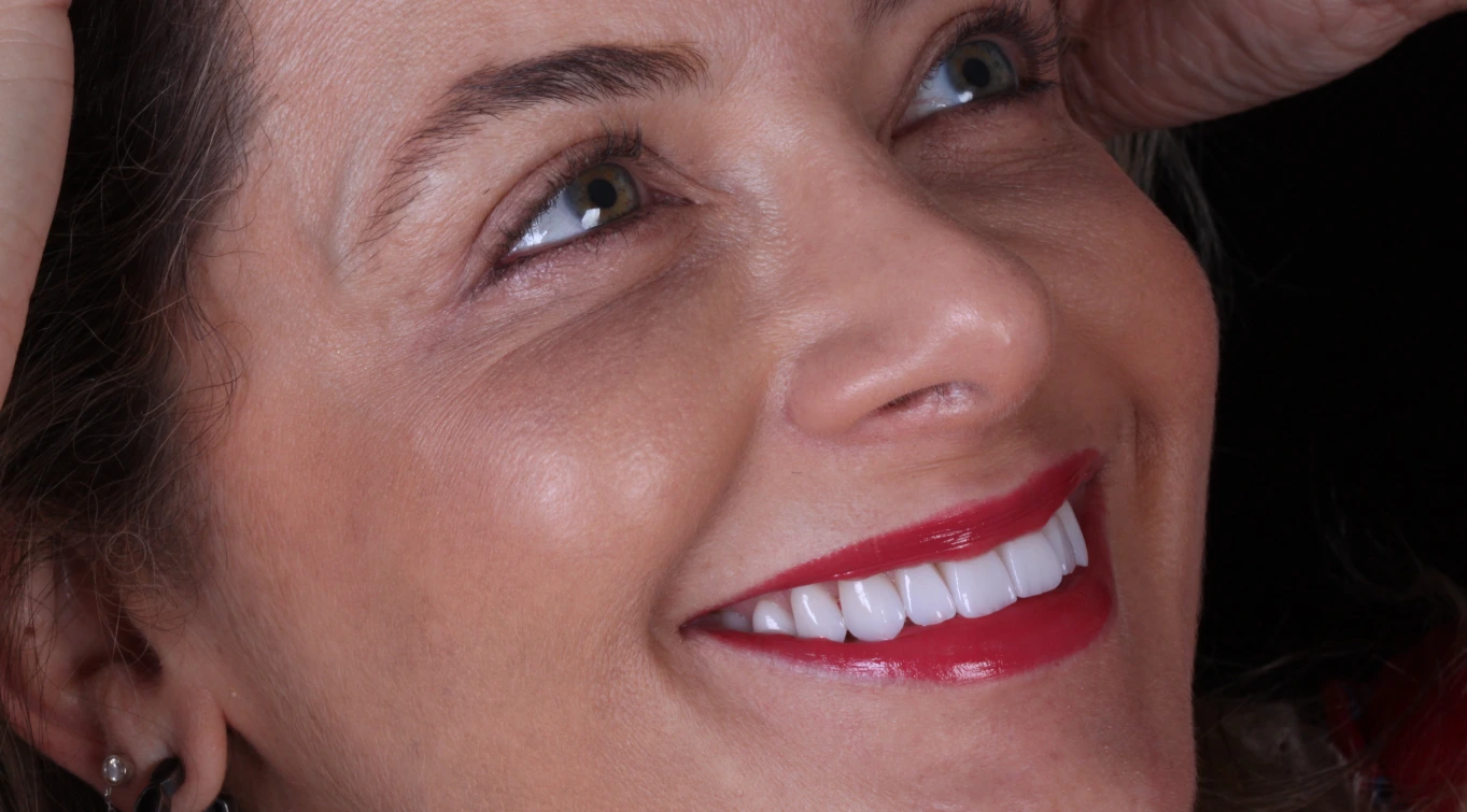 Mulher maquiada e com um belo sorriso com lentes de contato dental da Estética Vitae.