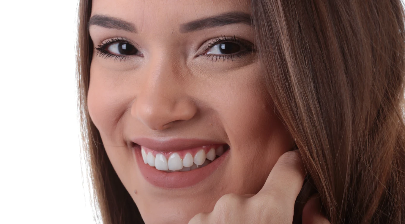 Mulher exibindo um belo sorriso com facetas de resina.